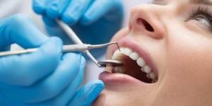 بالبلدي: التهاب اللثة وخراجات الأسنان تسبب الصداع النصفى